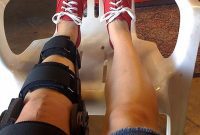 Creating a Safe Home for Knee Surgery Recovery